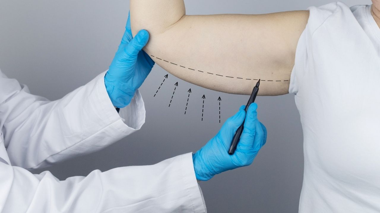 خطوات عملية شد الذراعين في تركيا